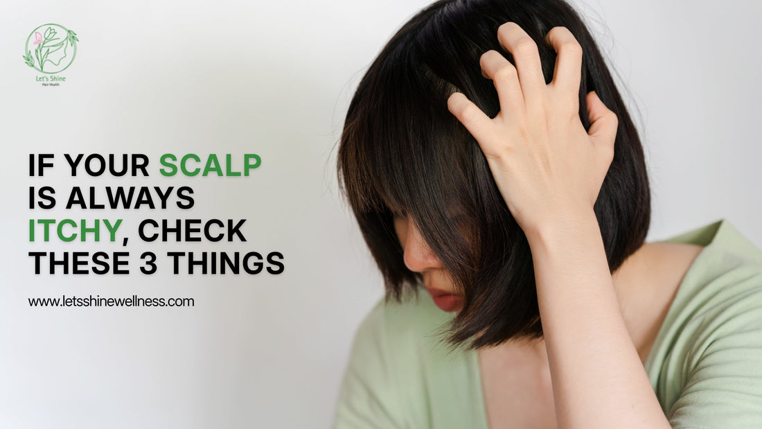 If Your Scalp Is Always Itchy, Check These 3 Things