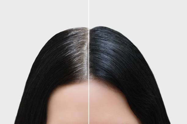 Why Grey Coverage Can Start Feeling Harsh on Hair 
