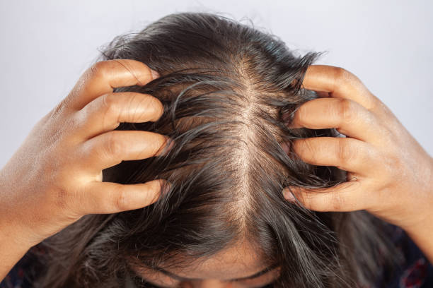Why Hair Can Start Feeling Thin & Weak 